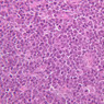 B16, Ileum, 40x (H&E)