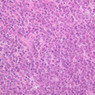 B16, Ileum, 40x (H&E)