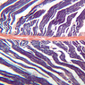 A19, Tendon, 2.5x (PTAH)