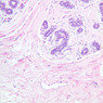 A93, Mammary, 10x (H&E)