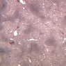A37, Spleen, 2.5x (Reticulin)