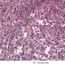 A37, Spleen, 40x Labeled (Reticulin)