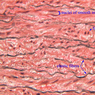 A27, Aorta, 40x Labeled (Verhoeff)