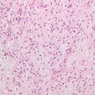 B63, Pituitary, 20x (H&E)