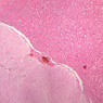 B63, Pituitary, 2.5x (H&E)