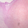 B64, Pituitary, 2.5x (AF)