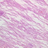 B64, Pituitary, 40x (AF)