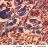 B65, Pituitary, 40x Labeled (Trichrome)