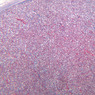 B65, Pituitary, 2.5x (Trichrome)