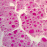 B51, Thyroid, 20x (Pb)