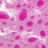 B51, Thyroid, 40x (Pb)