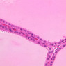 B52, Thyroid, 40x (H&E)