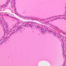 B52, Thyroid, 20x (H&E)