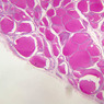 B53, Thyroid, 2.5x (PAS)