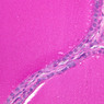 B53, Thyroid, 40x (PAS)