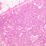 B56, Parathyroid, 10x (H&E)