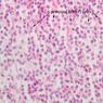 B56, Parathyroid, 40x Labeled (H&E)