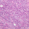 B56, Parathyroid, 20x (H&E)