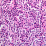 B56, Parathyroid, 40x (H&E)