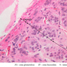 B59, Adrenal Gland, 40x Labeled (H&E)