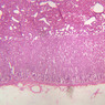 B60, Adrenal Gland, 2.5x (H&E)