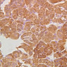 B61, Adrenal Gland, 40x (Chromaffin)