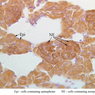B61, Adrenal Gland, 40x Labeled (Chromaffin)