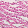 B62, Adrenal Gland, 40x (H&E)