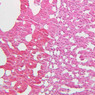B62, Adrenal Gland, 20x (H&E)