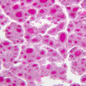 Endocrine
