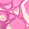 Endocrine