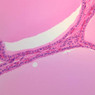 Endocrine