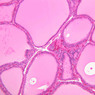 Endocrine