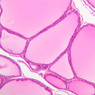 Endocrine
