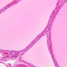 Endocrine