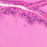 Endocrine