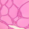Endocrine