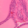 Endocrine