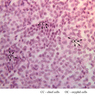 Endocrine