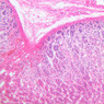 Endocrine