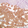 Endocrine
