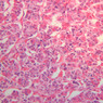 Endocrine