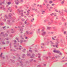 Endocrine