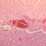 Endocrine