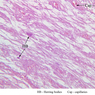 Endocrine