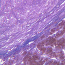 Endocrine