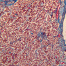 Endocrine