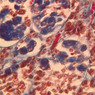Endocrine