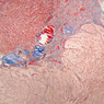 Endocrine