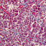 Endocrine